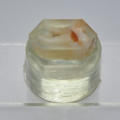 human tooth embedded